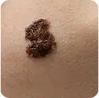 Servicios dermatológicos