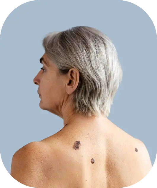 Servicios dermatológicos