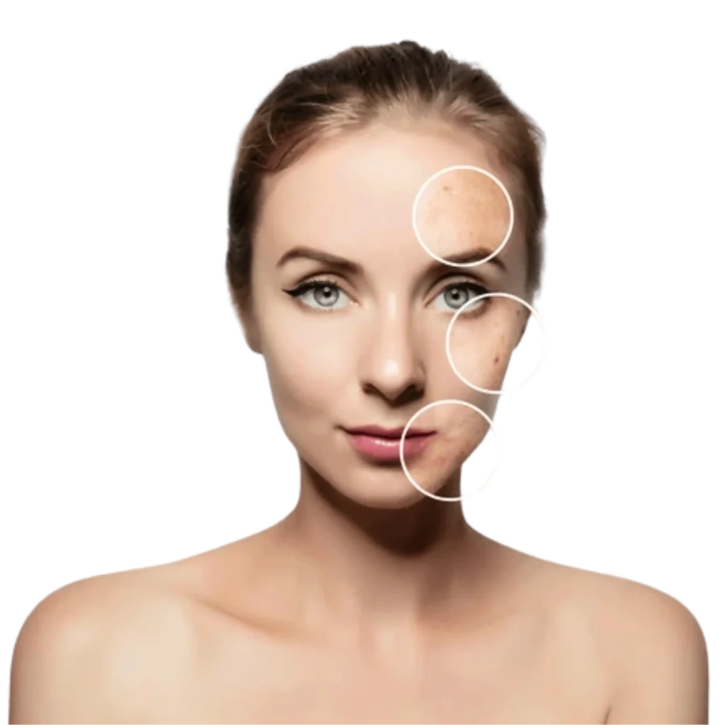 Dermatólogo en Monterrey y Ciudad Valles