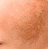 Imágen de paño - Dermapell